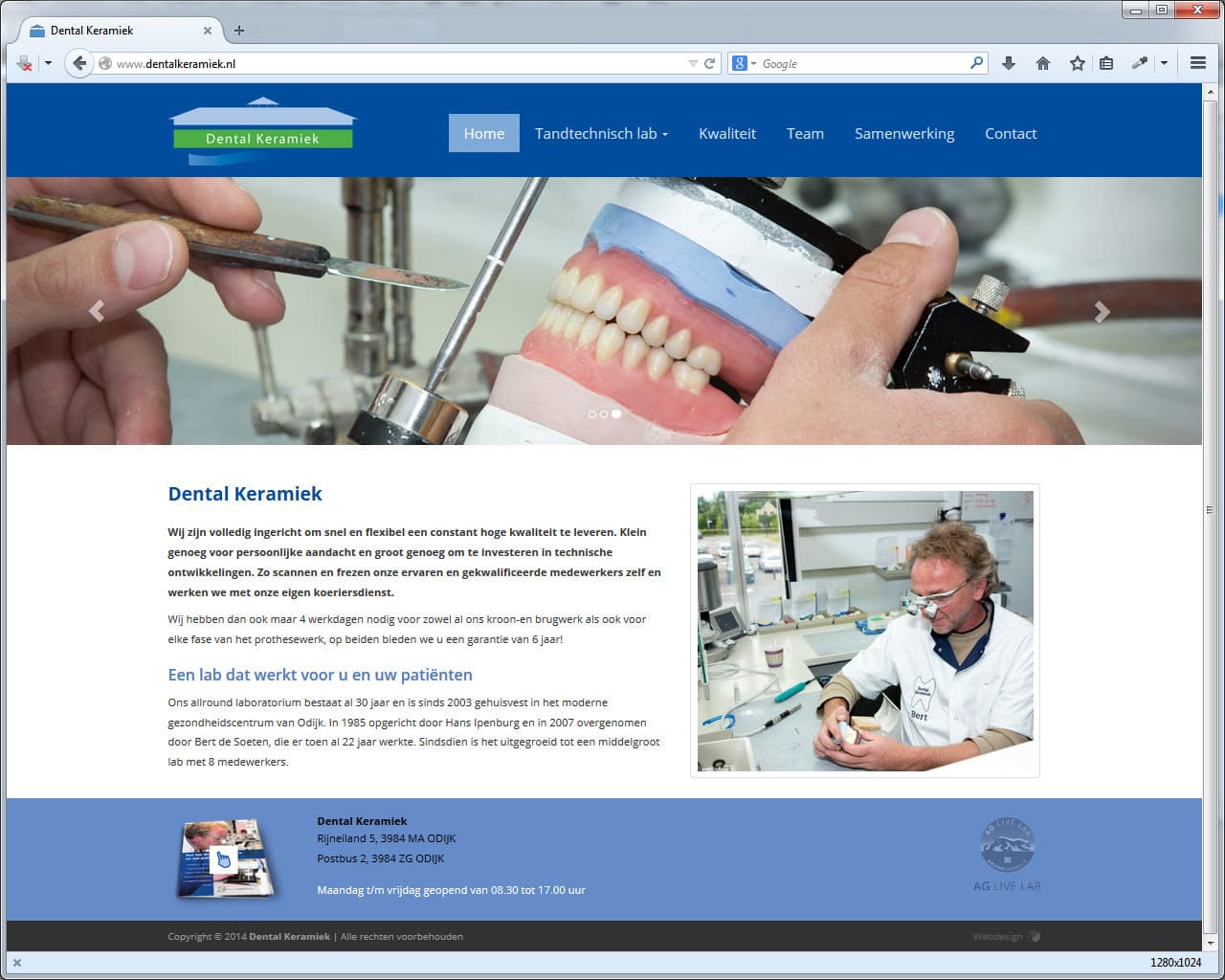 Voorbeeld Dental Keramiek